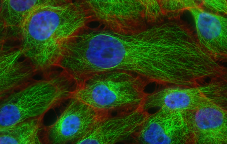 Cell Biology in Tübingen: Deadlines